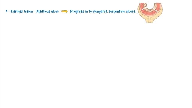 Crohn's Disease : Causes, Pathogenesis, Clinical Presentation, Diagnosis & Treatment