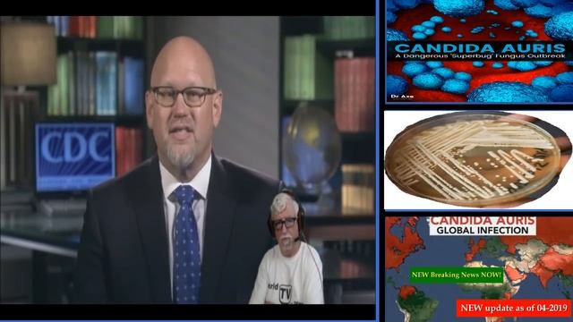 Candida Auris Outbreak update April 04 2019 BREAKING NEWS from the CDC смотреть онлайн