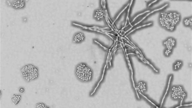 Ashbya Gossypii Vs Saccharomyces Cerevisiae