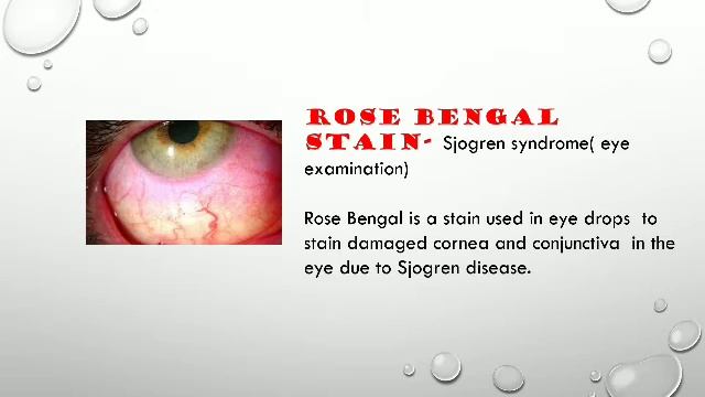 Roses in medicine смотреть онлайн