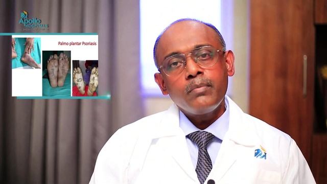 What do you know about 