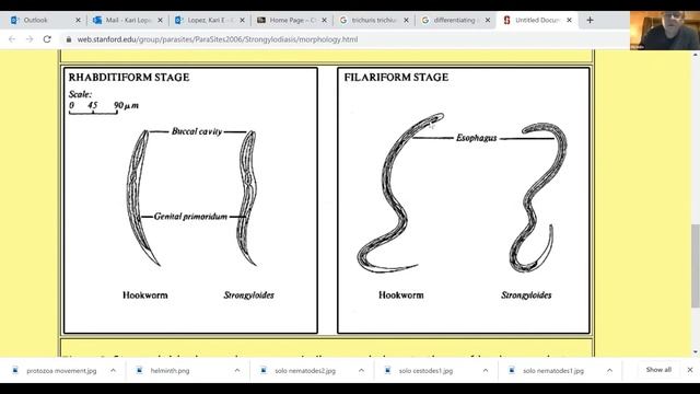 Differentiating Hookworm from Threadworm смотреть онлайн