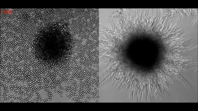 Human neutrophil swarming blocks the growth of Candida albicans