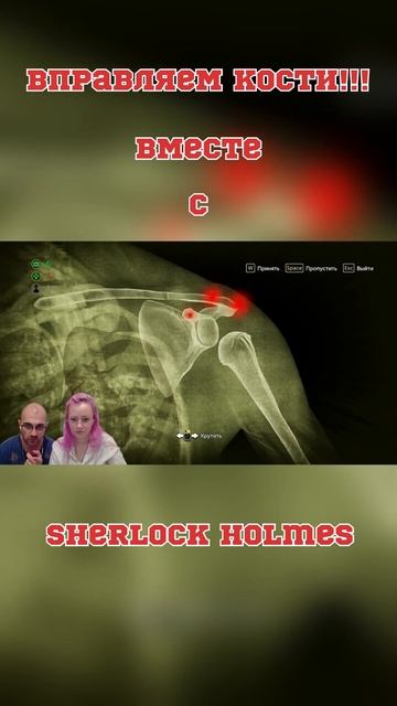 Лечим вывих плеча смотреть онлайн