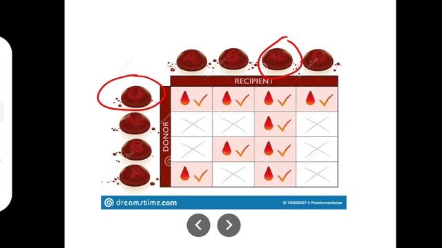 Blood group determination смотреть онлайн