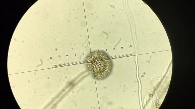 Aspergillus niger explained смотреть онлайн
