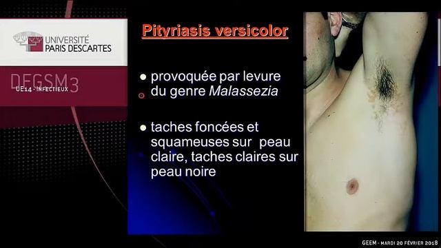 Parasitoses et mycoses cutanées
#parasitose_cutanée #mycose_cutanée смотреть онлайн