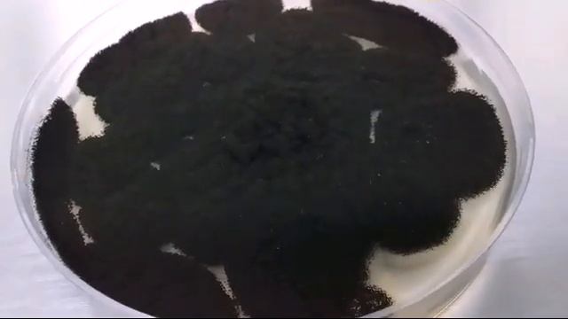 Aspergillus niger/Macroscopy/Microscopy смотреть онлайн