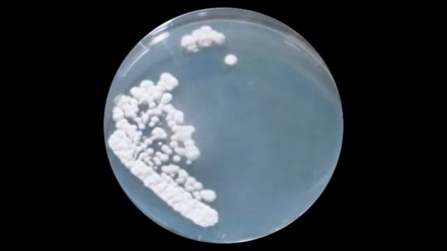 Penicillium смотреть онлайн