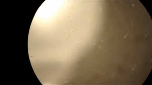 Cercárias Schistosoma mansoni 02 смотреть онлайн