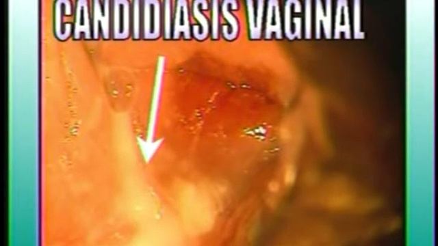 E T S смотреть онлайн