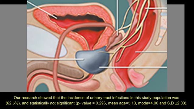Research on the Lower Urinary Tract Infectionsamong Patients Diagnosed of Benign ProstateHyperplasi смотреть онлайн