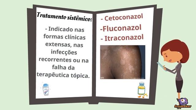 Tratamento Ptiriase Versicolor