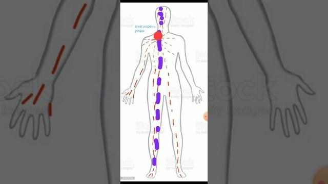 Алергены и обострения. смотреть онлайн