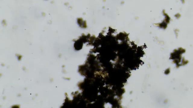 Microscope video Asplanchna priodonta смотреть онлайн