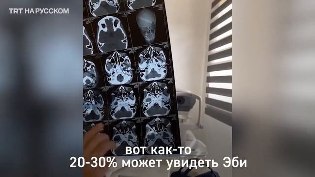 ЭБИ, МАЛЬЧИК КОТОРОГО ОБЛИЛИ КИСЛОТОЙ. смотреть онлайн