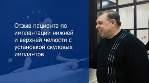 Отзыв пациента по имплантации верхней и нижней челюсти