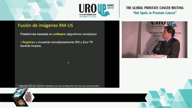 08- URO UP 2016: Biopsia de fusión y RM-MP (Dr. Ernesto Castillo) смотреть онлайн
