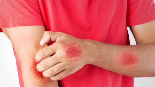 12 Most Dangerous Bugs in the World смотреть онлайн
