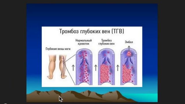 пат анат 22 03 2022 19 50 42 смотреть онлайн