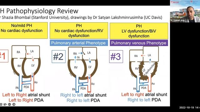 Congenital Diaphragmatic Hernia - Phenotyping Cardiovascular Profile to Provide Precision Managemen смотреть онлайн