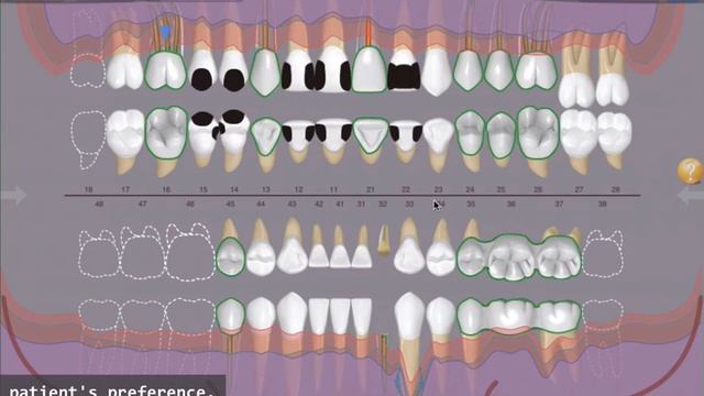 [Yayi technology] "E-Dentist's" featured video_English version смотреть онлайн