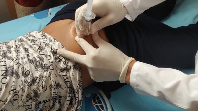 butt injection смотреть онлайн