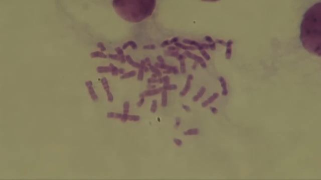Cytogenetics. Human chromosomes. Karyotype. смотреть онлайн