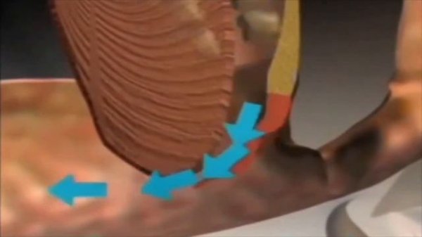 Средство от храпа антихрап спрей - смотрите и убедитесь!