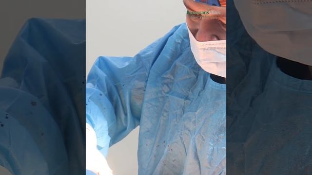 Liposaksiya va abdominoplastika смотреть онлайн