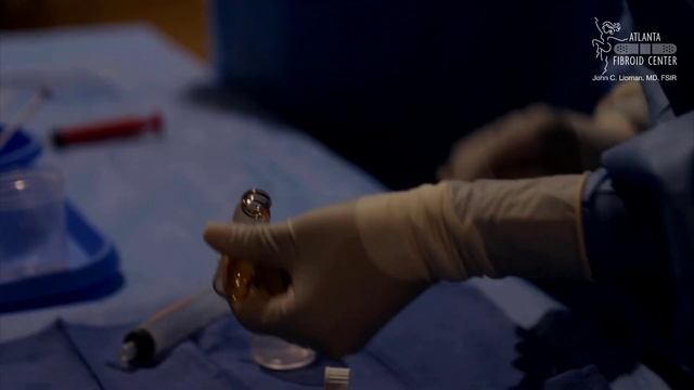 Uterine Fibroid Embolization (UFE) - Full Procedure Video - Atlanta Fibroid Center смотреть онлайн