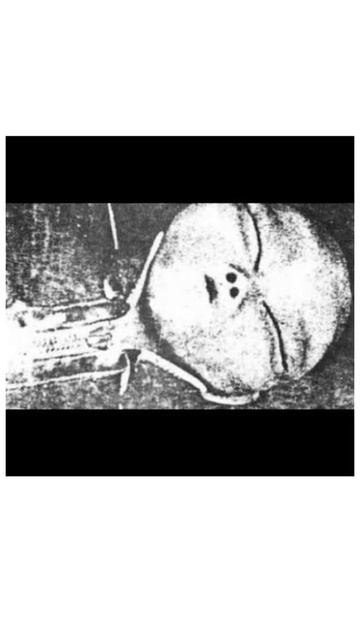 1947 roswell Injured alien autopsy photo..#shorts