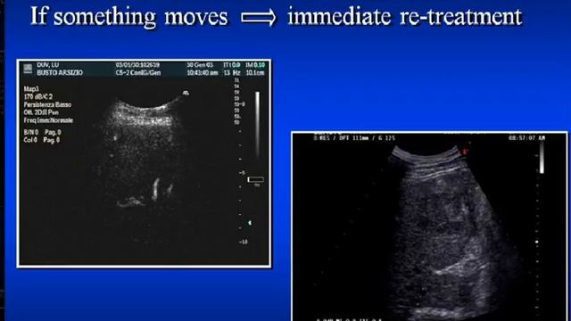 bracco bologna solbiati смотреть онлайн