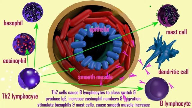 ASTHMA INVOLVES COMPLEX IMMUNE INTERACTIONS смотреть онлайн