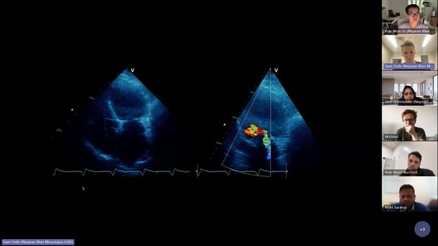 LV Systolic Function And Cardiac Output