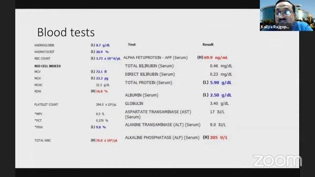 PG CLINICS MASS ABDOMEN смотреть онлайн