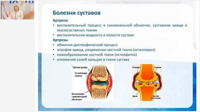 Лузгинова С.В. «КФС «АРТЕНОЛ» И ПРОФИЛАКТИКА ЗАБОЛЕВАНИЙ СУСТАВОВ» 6.07.23 смотреть онлайн