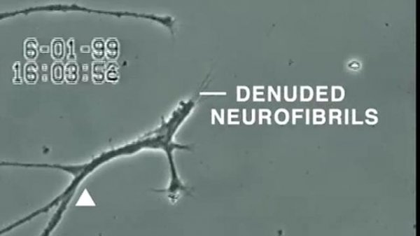 How Mercury destroys neurological tissue