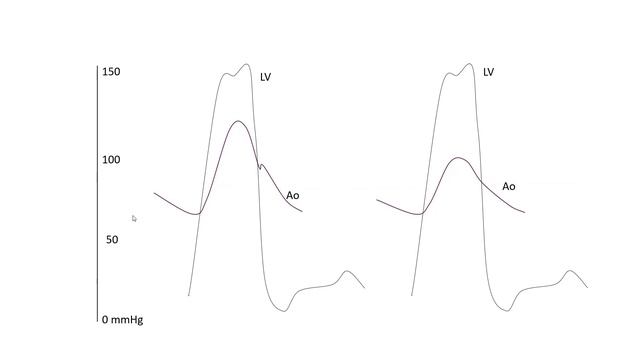 Hemodynamic cases- part 2 смотреть онлайн