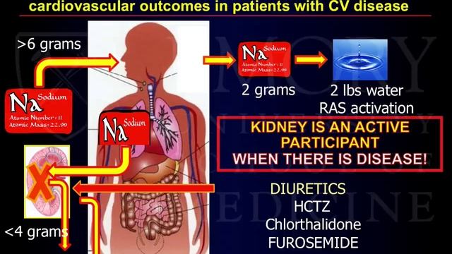 Emory Cardiology Grand Rounds 10-27-2014 смотреть онлайн
