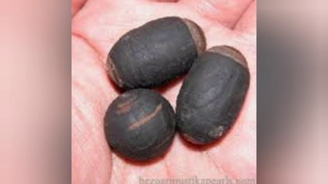 ГЕМОРРОЙ - выбираем самые эффективные и безопасные средства 📑