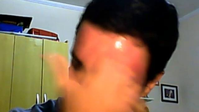 50% TCA Peel - The Results - Day 5 - Trying to get rid of acne scars and melasma смотреть онлайн