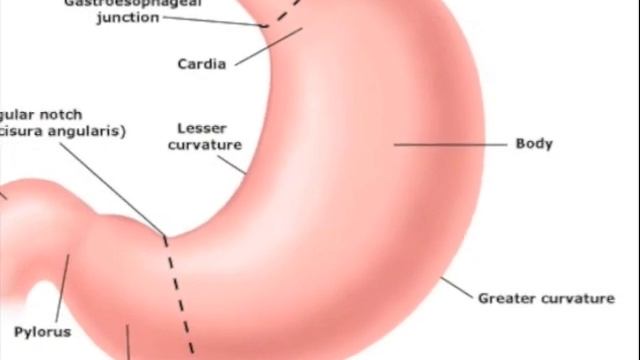 Gastric Sleeve With Hiatal Hernia Repair | Weight Loss Surgery | Dr Alvarez смотреть онлайн