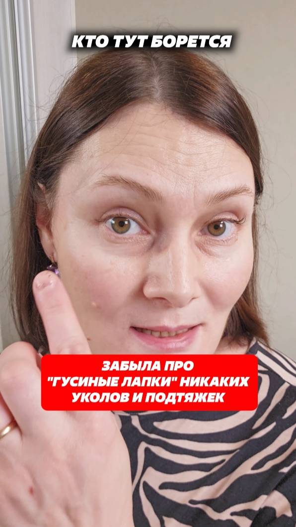 Забыла про "гусиные лапки". Никаких уколов и подтяжек. Артикул 263656817 #уход #морщины #крем смотреть онлайн