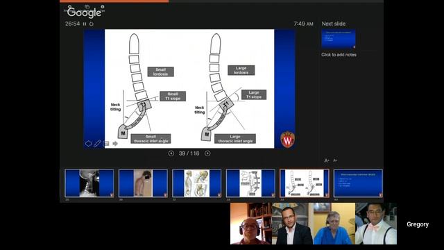 THIRD VIDEO OF SPINE CONFERENCE смотреть онлайн