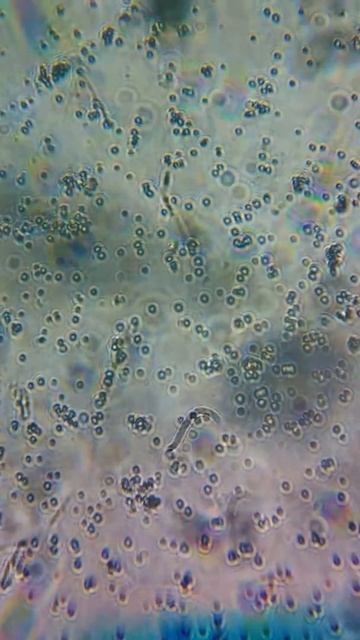 Плесень под микроскопом