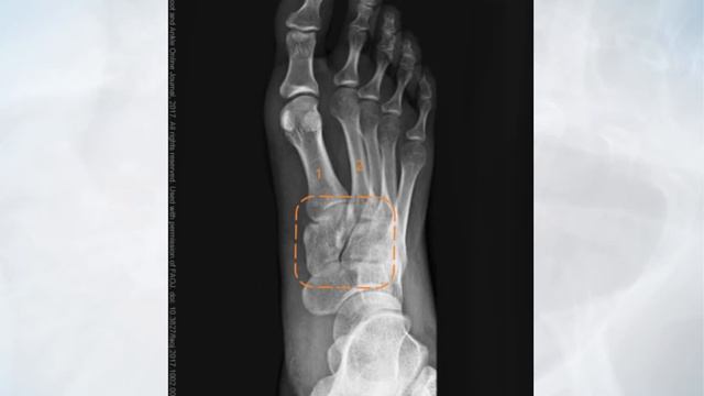Foot смотреть онлайн