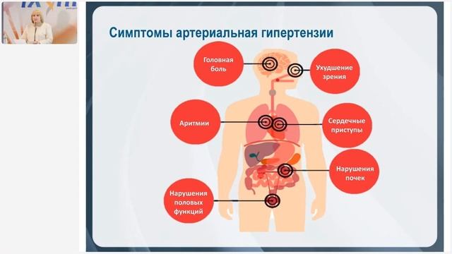 Лузгинова С.В.«ПРОФИЛАКТИКА РАЗВИТИЯ ГИПЕРТОНИИ С ПОМОЩЬЮ ПРИМЕНЕНИЯ ПРОДУКЦИИ КОМПАНИИ»Ч.2»28.03.2 смотреть онлайн