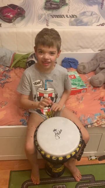 Джембе , Дима играет ветрянка не помеха смотреть онлайн