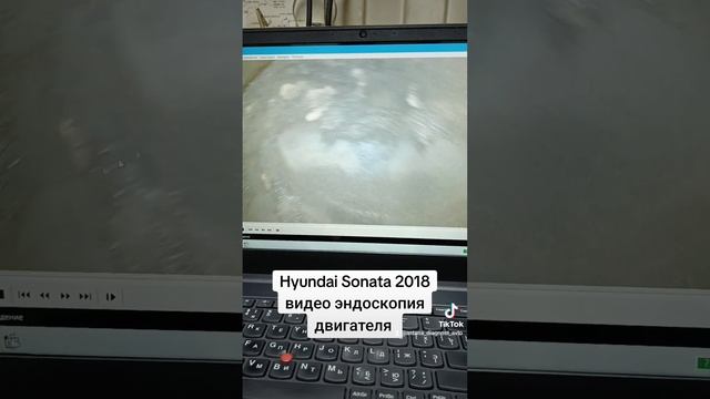 Hyundai Sonata эндоскопия двигателя. #hyundai  #sonata #hyundaisonata #эндоскопия